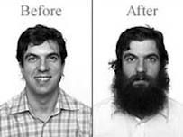 jacobsbeforeafter